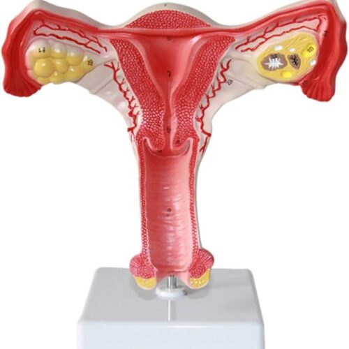 Uterus Maketi